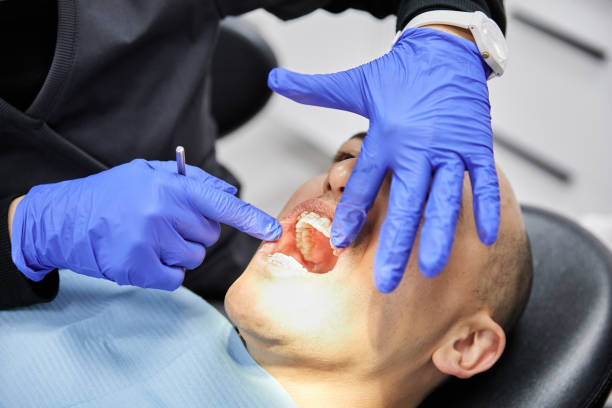 Best Chipped Tooth Repair Near Me  in Columbia, IL
