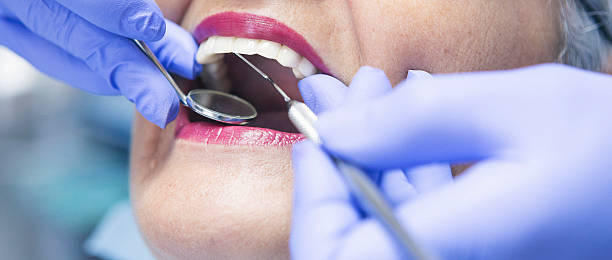 Best Cracked Tooth Emergency Dentist  in Columbia, IL
